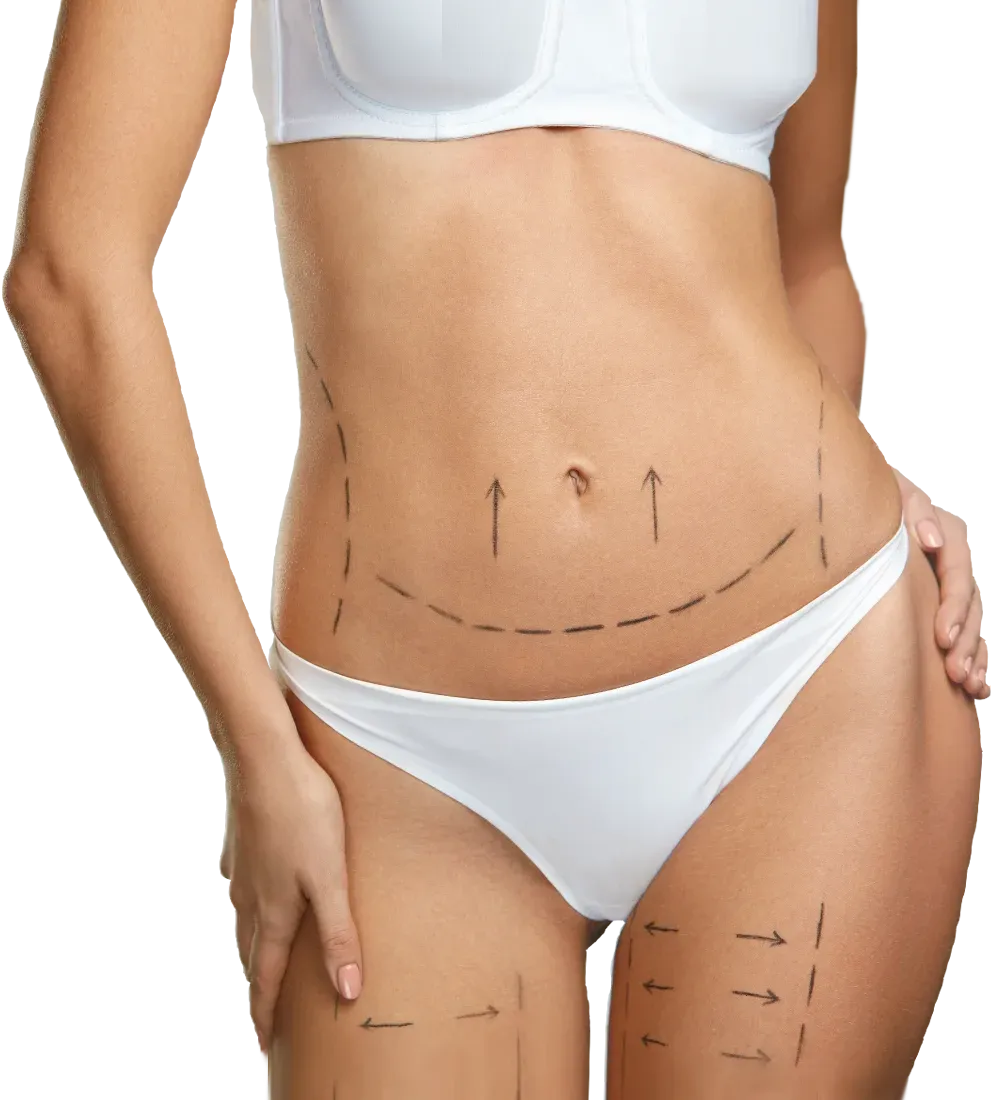 Marcaciones prequirúrgicas para cirugías corporales